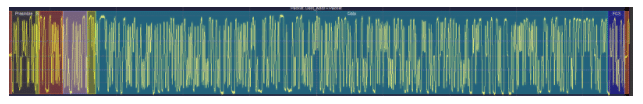 A 100BASE-T1 packet consisting of SSD and ESD denoted using red bars at edges